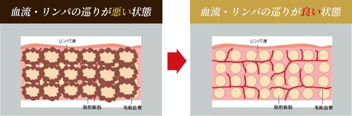 血流やリンパの巡りが悪い状態・いい状態
