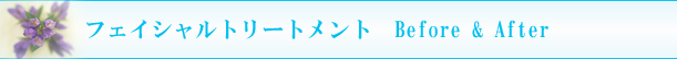 ���R��՗� �G�X�e ��X�p�o���b���R�����R�s������,���Ճ_�C�G�b�g,
